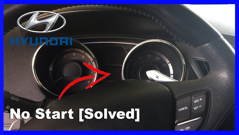 Car Wont Start Hyundai