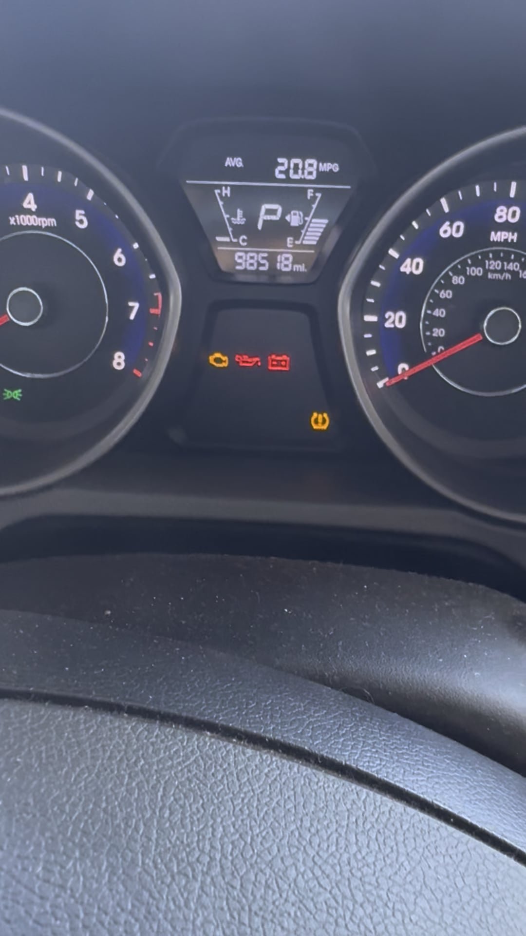 Car Won't Start Hyundai: Top Causes and Quick Fixes